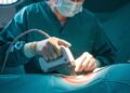How Defective Surgical Staplers Can Lead to Severe Post-Surgery ...