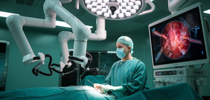 Surgical staplers | Infiniti Medical